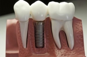 Основные направления стоматологии