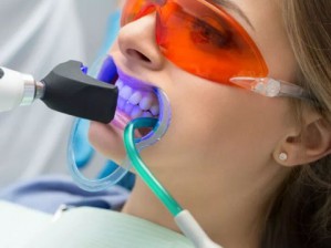 Лазерное отбеливание зубов всего за 1000 грн